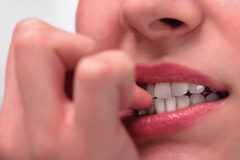  Hábitos bucales no fisiológicos y su manejo odontológico