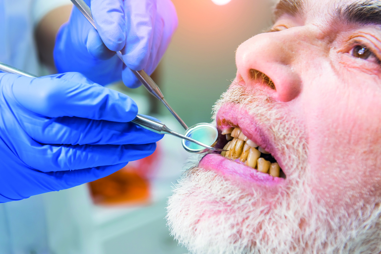  Consideraciones en el tratamiento odontológico del adulto mayor
