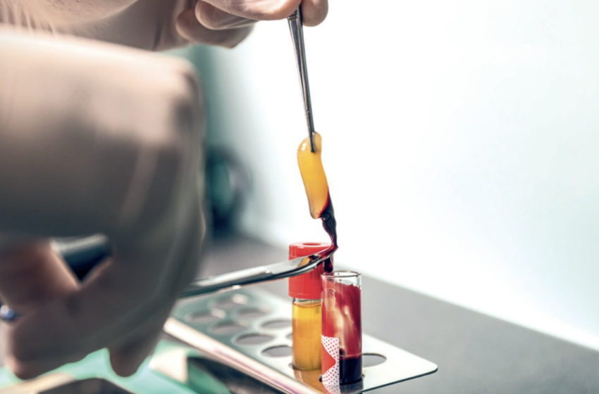  Uso de fibrina rica en plaquetas en periodoncia e implantología
