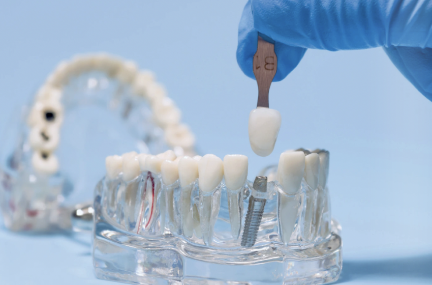  Manejo de tejidos blandos en odontología: claves para la estética y estabilidad